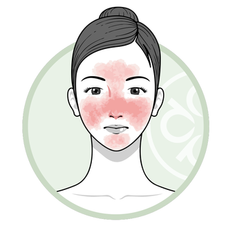 redness icon